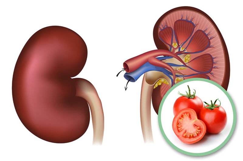 Cà chua cũng rất giàu kali, có thể làm suy giảm chức năng thận. Nếu bạn đã gặp các vấn đề về thận, hãy lưu ý khi ăn cà chua.
