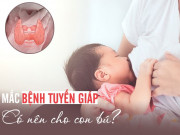 Sức khỏe - Nỗi lo của nhiều mẹ Việt: Mắc bệnh tuyến giáp có được sinh con và cho con bú?