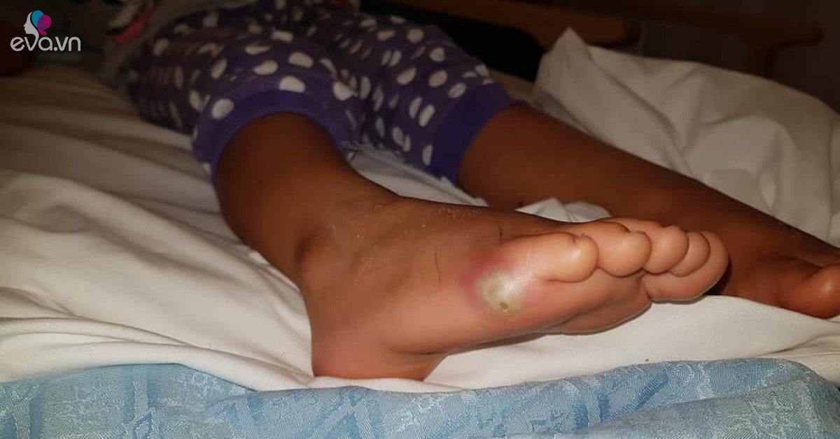 Con bị nhiễm trùng huyết sau hôm đi mua giày, mẹ hối hận khi bác sĩ giải thích lý do