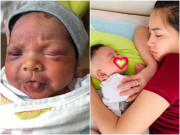 Làm mẹ - Nhìn ảnh hiện tại con trai Hải Băng, ai nghĩ bé từng sinh thiếu tháng lại thâm tím khắp mặt