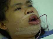 Làm đẹp mỗi ngày - Chuyện chưa kể về ca phẫu thuật thẩm mỹ của “cô gái mặt quặp” Tường Vy