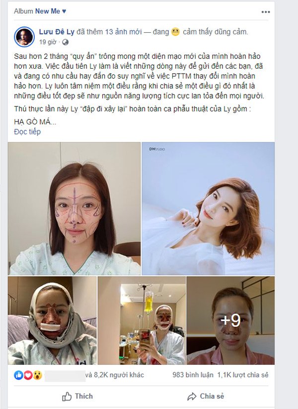 PTTM cùng lúc 5 bộ phận, gương mặt mới của Lưu Đê Ly khiến ai cũng bất ngờ - 1