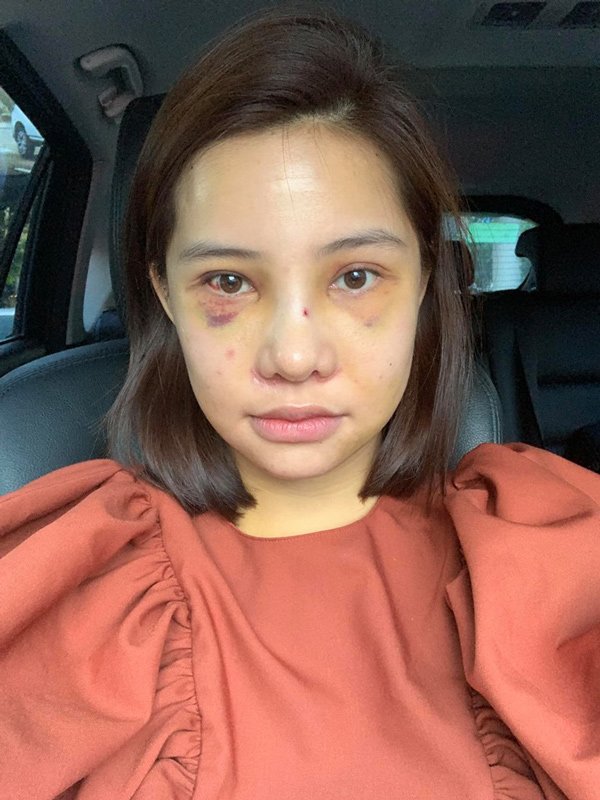 PTTM cùng lúc 5 bộ phận, gương mặt mới của Lưu Đê Ly khiến ai cũng bất ngờ - 7