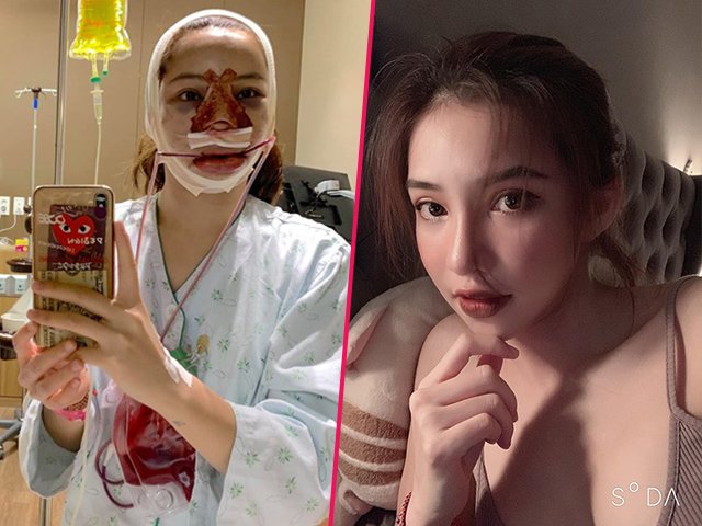 PTTM cùng lúc 5 bộ phận, gương mặt mới của Lưu Đê Ly khiến ai cũng bất ngờ