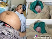 Bà bầu - Mẹ 9X đăng ảnh bụng bầu "khổng lồ" rạn be bét, câu chuyện phía sau càng xót xa
