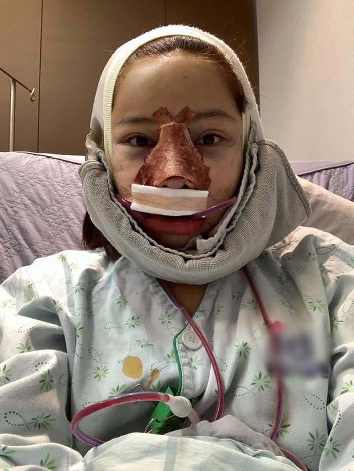 PTTM cùng lúc 5 bộ phận, gương mặt mới của Lưu Đê Ly khiến ai cũng bất ngờ - 3