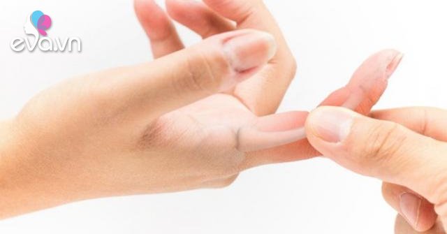 Tại sao lại bị đau khớp ngón tay?
