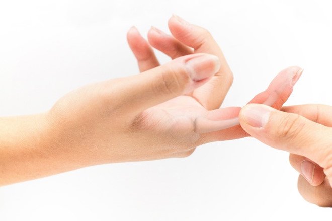Tại sao lại bị đau khớp ngón tay? - 1
