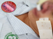 Sức khỏe - Những người nào dễ bị vi khuẩn "ăn mòn" cơ thể Whitmore tấn công