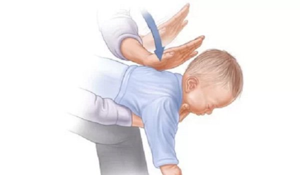 Trẻ sơ sinh bị ho: Nguyên nhân, cách chữa trị và phòng tránh - 5