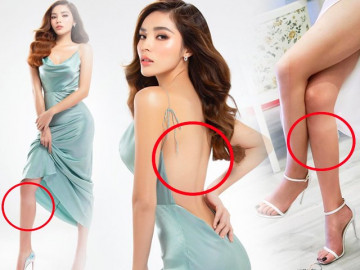 Loang lổ kém thẩm mỹ vì cháy nắng, Kỳ Duyên vẫn thấy tự hào về đôi chân của mình