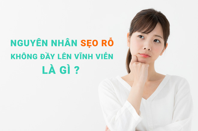 chuyen gia da lieu tiet lo bi quyet de seo ro day len vinh vien - 1