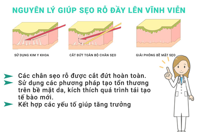 chuyen gia da lieu tiet lo bi quyet de seo ro day len vinh vien - 2