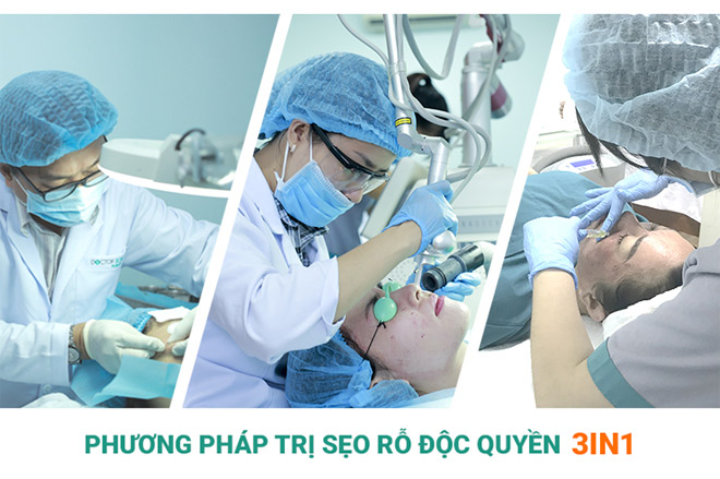 Chuyên gia da liễu tiết lộ bí quyết để sẹo rỗ đầy lên vĩnh viễn - 3