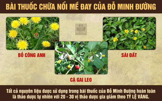 Nhà thuốc Đỗ Minh Đường chữa bệnh nổi mề đay có thực sự hiệu quả? - 2