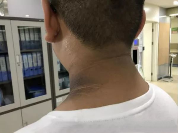 Đưa con đi khám vì amp;#34;vết bẩn” trên cổ, kết quả khiến mẹ sững sờ còn bà thì hối hận - 2