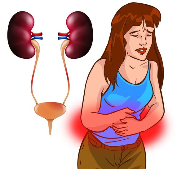 Bụng đầy hơi ai cũng gặp nhưng cẩn thận nó có thể cảnh báo 6 bệnh nguy hiểm chết người - 1