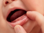 Làm mẹ - Bé mọc răng chậm cha mẹ nên xử trí thế nào?