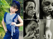 Làm mẹ - Mẹ đăng ảnh con gái bị thương nặng khiến dân mạng hốt hoảng, bức ảnh cuối nói lên sự thật