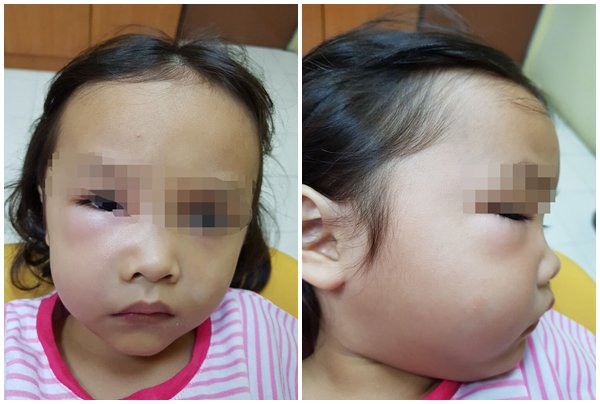 be gai suyt chet vi sau rang, nha si trach cha me hai con vi thoi quen tai hai - 1