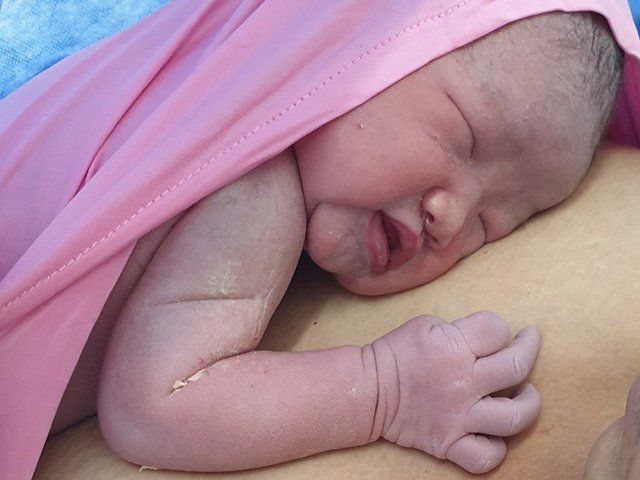 Đã triệt sản thành công, mẹ 3 con ngớ người phát hiện mang thai đứa thứ 4