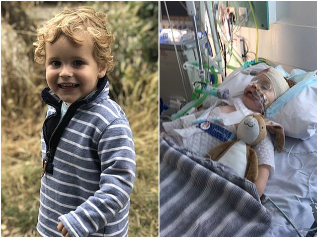 Bé trai 2 tuổi chảy máu não, hôn mê suốt 1 tuần sau khi ngã từ ghế xuống đất