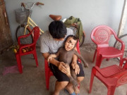 Tin tức - Vợ bầu 7 tháng tử vong, chồng đau đớn ôm con 20 tháng với làn da ai nhìn cũng sợ