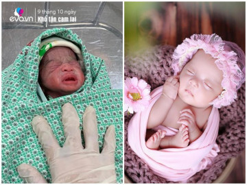 Mẹ Hà Nội mang bầu đôi, 29 tuần đi sinh chỉ bế được một con trên tay