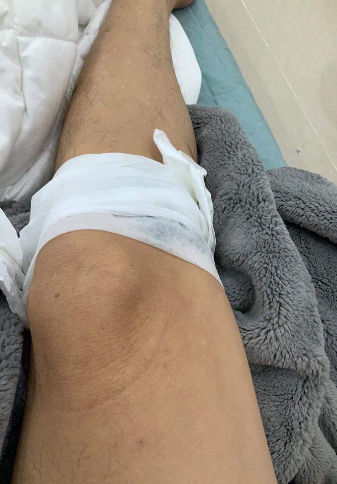 Sao Việt 24h: Hoài Linh bị thương phải băng chân, fan vừa thương vừa buồn cười - 1