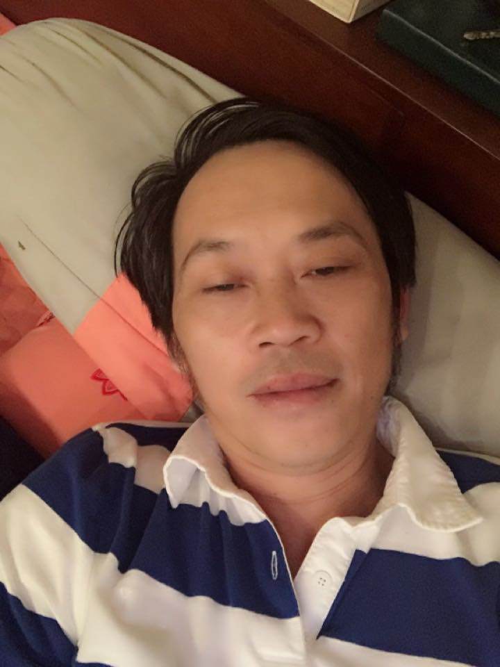 Sao Việt 24h: Hoài Linh bị thương phải băng chân, fan vừa thương vừa buồn cười - 2