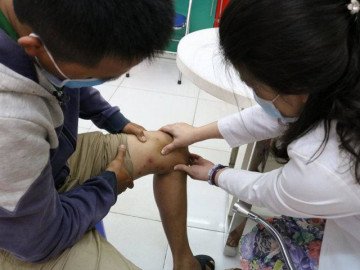 Kiến ba khoang tấn công người dân TP.HCM đầu mùa mưa, bác sĩ tư vấn cách phòng tránh