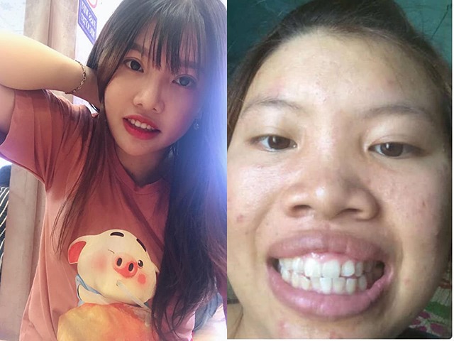 sau 4 nam dao keo gay bao mxh, phuong "thi no tai sinh" gio ra sao? - 1