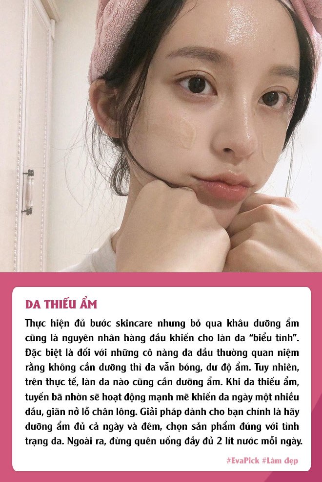 cang duong da cang do dau, lo chan long no to, phai chang buoc skincare cua ban co van de? - 4