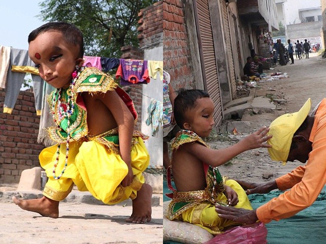 Sinh ra với ngoại hình kỳ dị, bé trai được tôn làm thần, trăm người đến xin ban phước