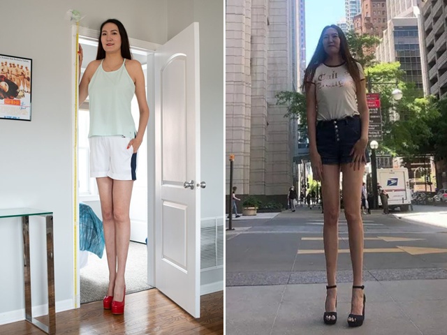 Cô gái có đôi chân 1,34m, dài thứ hai thế giới, nhìn sang bố mẹ còn choáng váng hơn