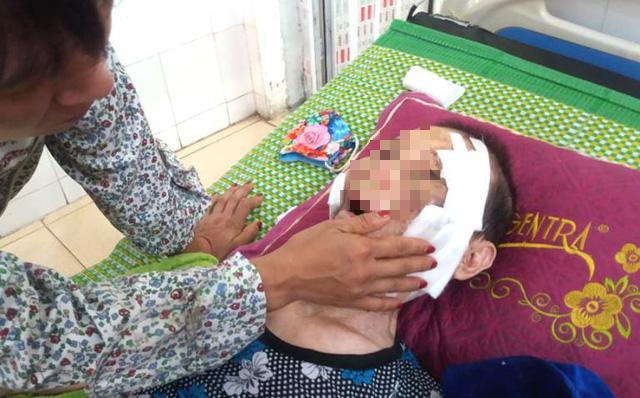 dau long con trai danh me gia 84 tuoi bai liet phai nhap vien cap cuu - 1