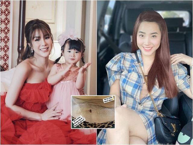 4 mỹ nhân Việt khoe vết rạn sau sinh: Diệp Lâm Anh vẫn đẹp, nhìn Hải Băng mà sợ