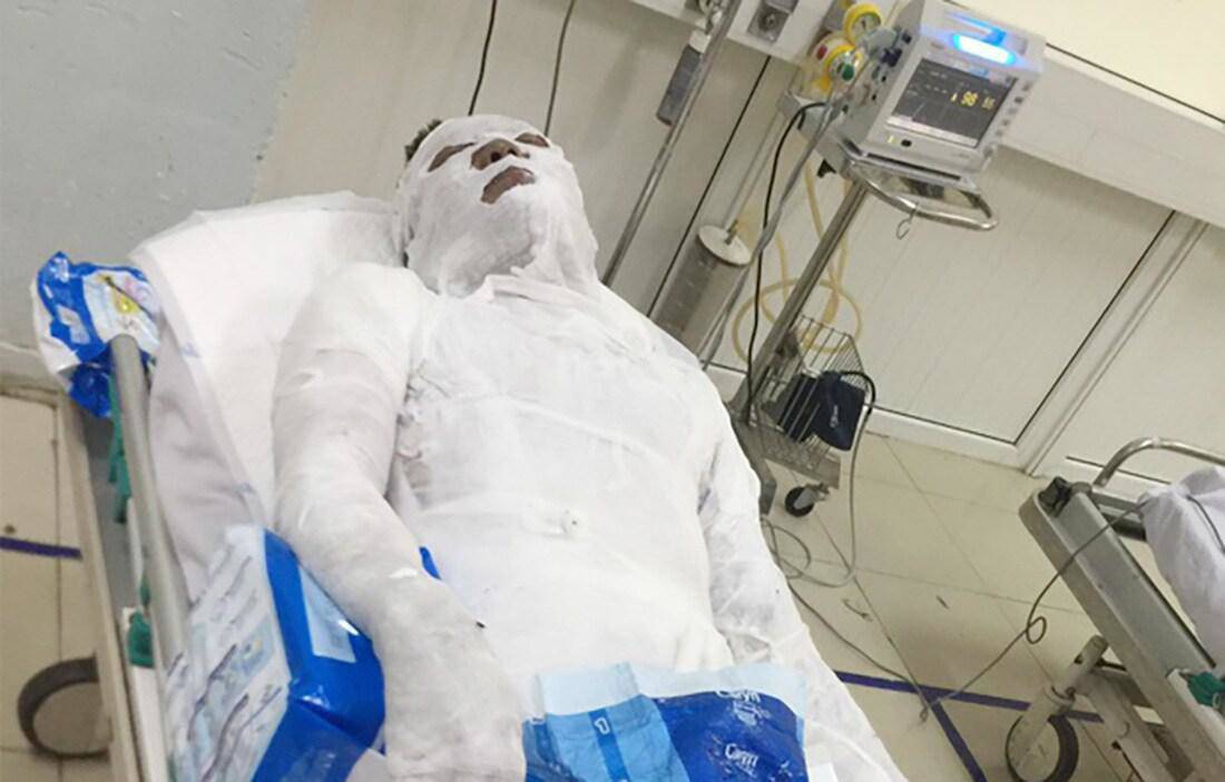 Tin tức 24h: Bất ngờ lý do cô dâu Thu Sao đột quỵ, nhập viện sau tân trang nhan sắc - 1