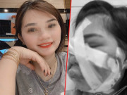 Làm đẹp - Cấy mỡ tự thân làm chị em lao đao: người mặt sưng phù, người qua đời trên bàn phẫu thuật