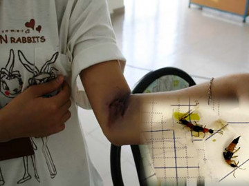 Kiến ba khoang tấn công cư dân TP HCM, chuyên gia chỉ cách xử lý để không phải nhập viện