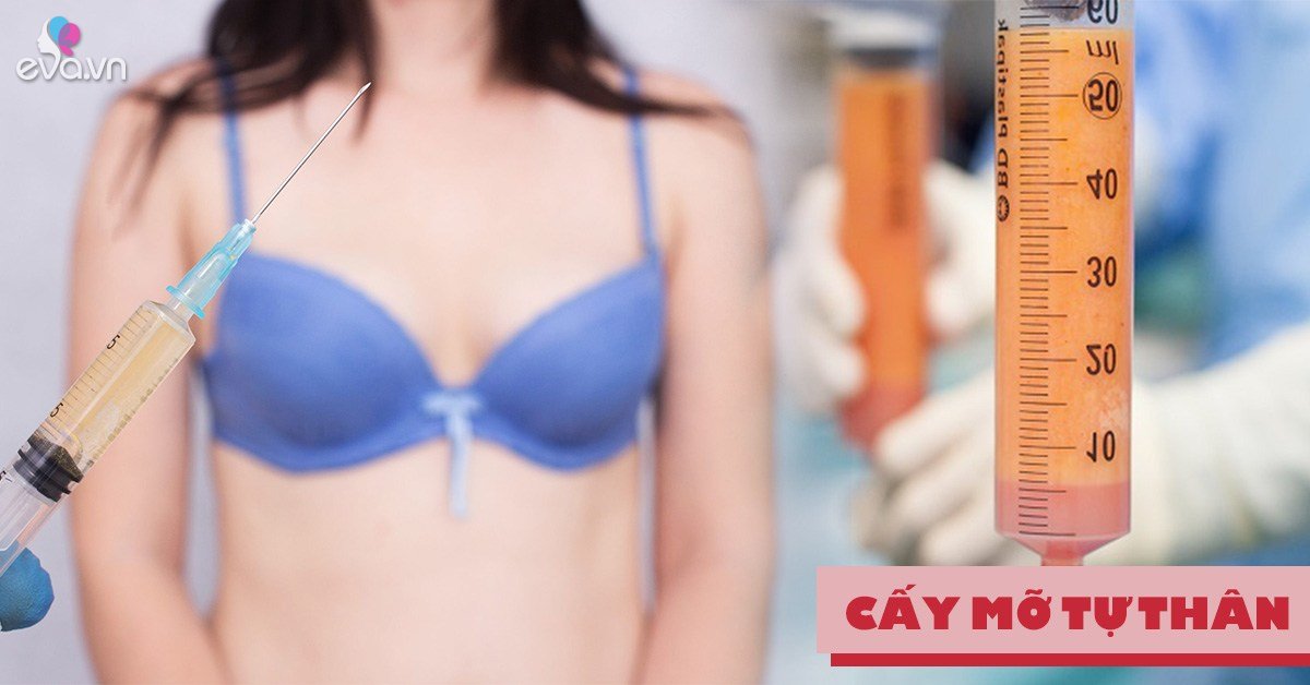 Để không gặp biến chứng, nàng lưu ngay các sai lầm phổ biến thường gặp khi cấy mỡ tự thân