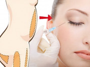 Làm đẹp - Những bộ phận an toàn cho kiểu làm đẹp hút mỡ chỗ thừa, "đắp đầy" chỗ thiếu nàng cần biết