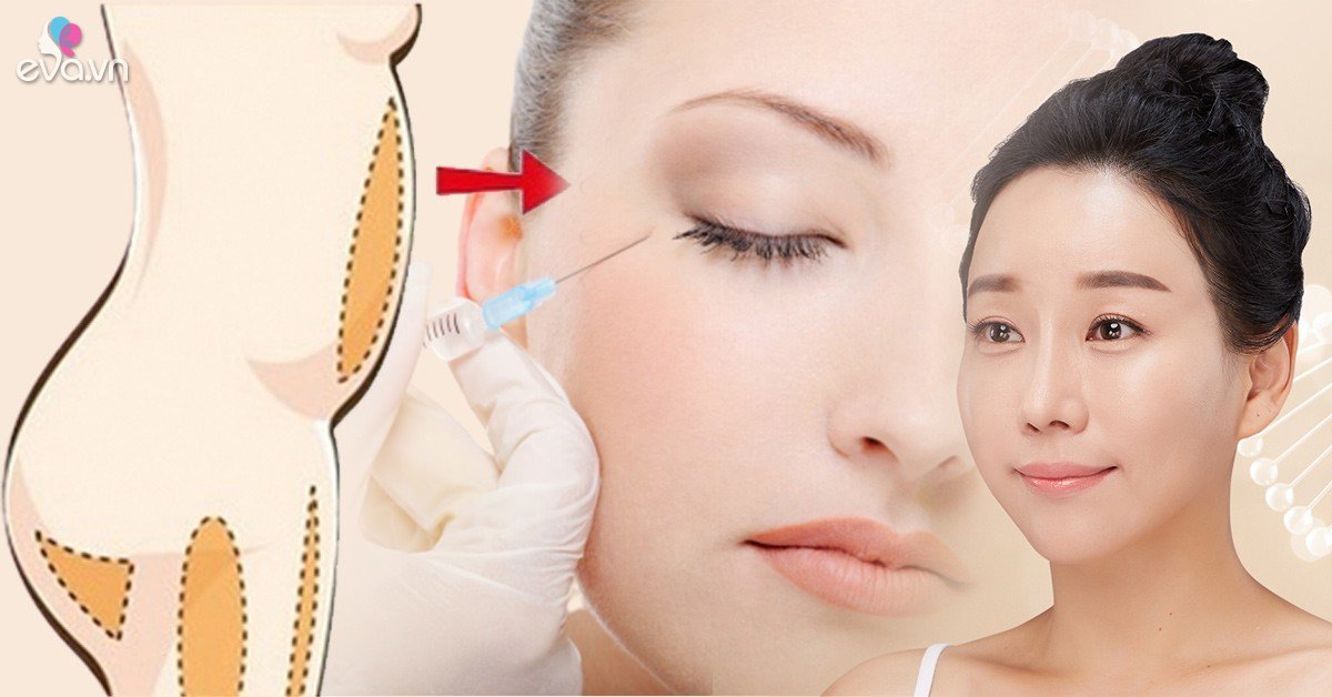 Những bộ phận an toàn cho kiểu làm đẹp hút mỡ chỗ thừa, đắp đầy chỗ thiếu nàng cần biết