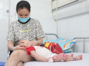 Sức khỏe - Cảnh báo số ca mắc tay chân miệng tại BV Nhi Trung ương đã tăng gấp 6 lần năm ngoái