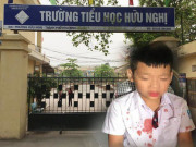 Tin tức - Hiệu trưởng lần đầu lên tiếng khi học sinh lớp 1 bị bố bạn học đánh tóe máu nhập viện