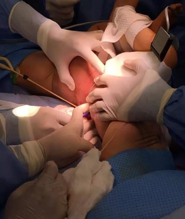 bac si chia se khoanh khac tach roi 2 be dinh lien: "ca nay khong kho khan nhu ca viet-duc" - 3