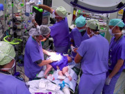 Bà bầu - Lặng người khi siêu âm song thai dính nhau, hình ảnh 2 bé gái sau phẫu thuật đẹp hoàn hảo