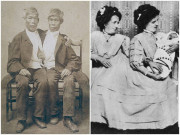 Sức khỏe - Những cặp song sinh dính liền không tách nhau vẫn sống sót, có trường hợp còn sinh 21 người con