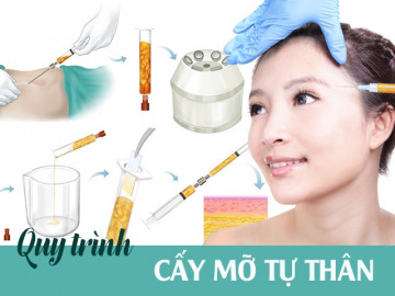 Mục sở thị quy trình cấy mỡ tự thân: nàng cần nắm ngay trước khi bước lên bàn hút mỡ