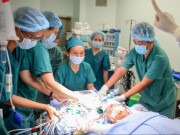 Sức khỏe - Kế hoạch tiếp theo với cặp song sinh dính liền hiếm gặp vừa được tách thành công